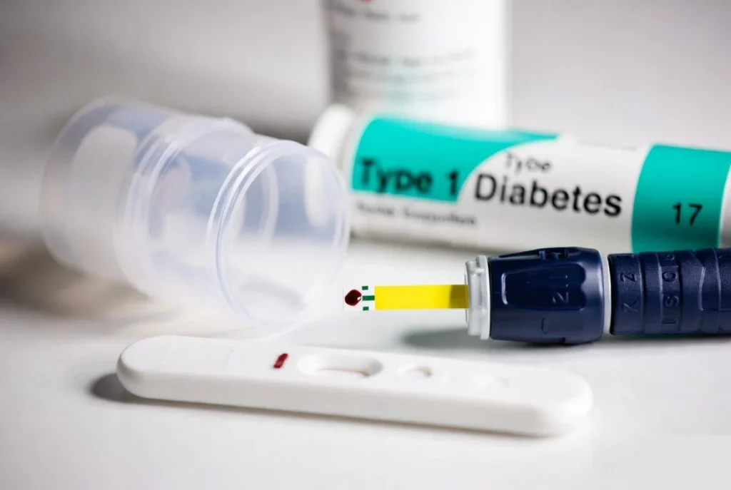 Type 1 Diabetes